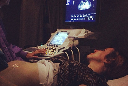 woman getting ultrasound